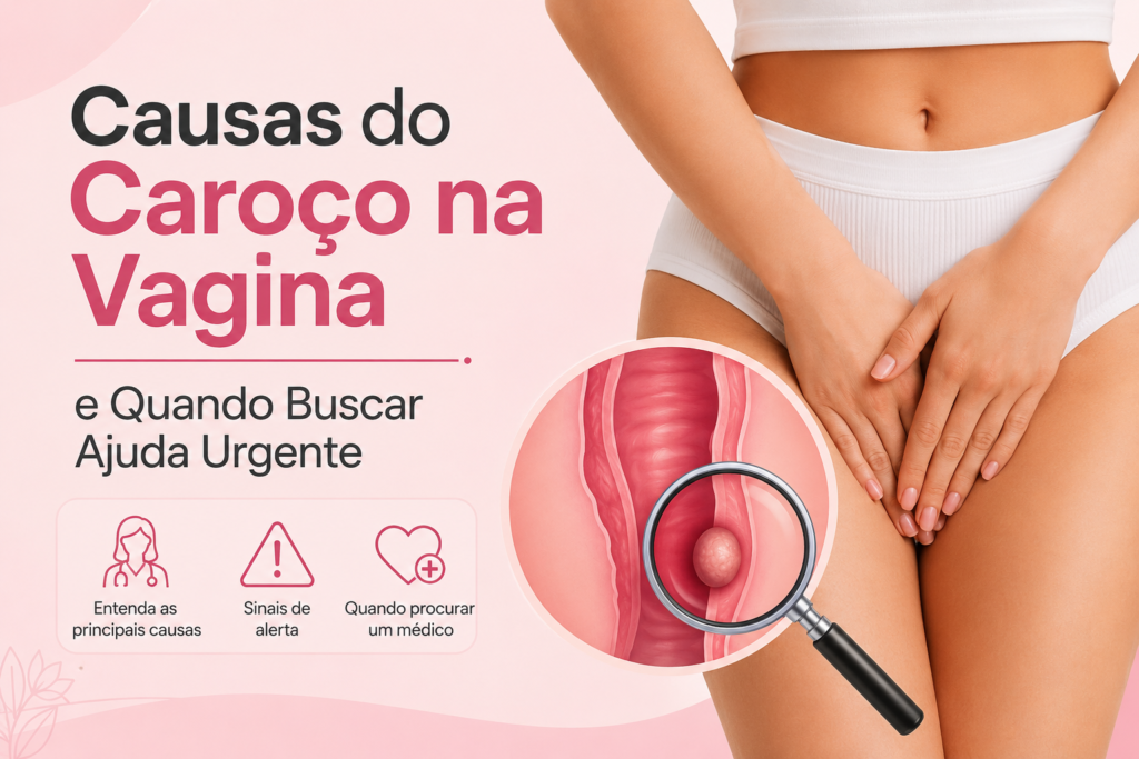 caroco na vagina o que pode ser, Ilustração sobre caroço na vagina mostrando causas, sinais de alerta e quando buscar atendimento médico.